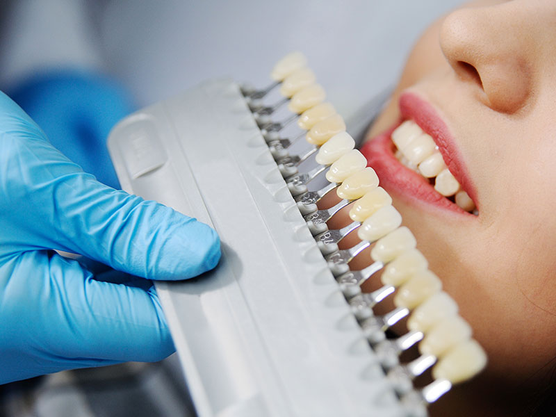 tooth crowns