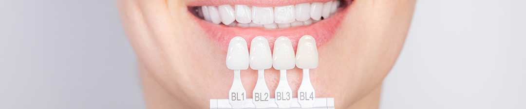Pros & Cons of Dental Veneers