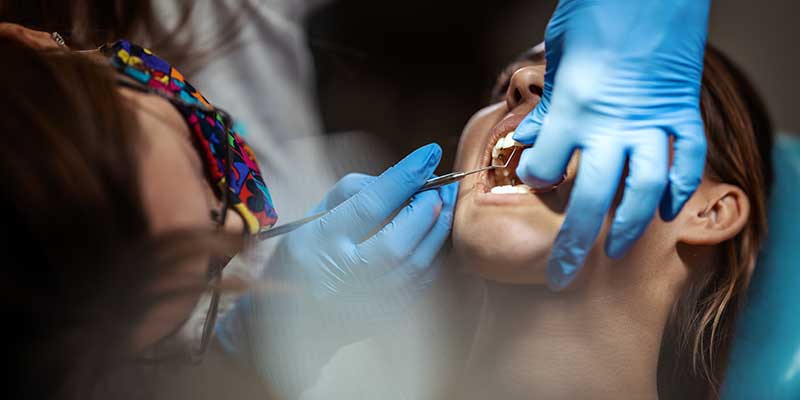 Teeth Bonding Services